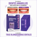 Tiras Blanqueadoras Dentales X14u Purple Whitening Strips